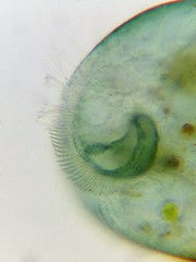 Stentor coeruleus