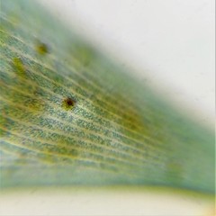 Stentor coeruleus