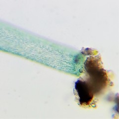 Stentor coeruleus