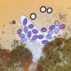 Ascobolus immersus