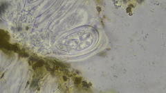 Candelariella xanthostigmoides