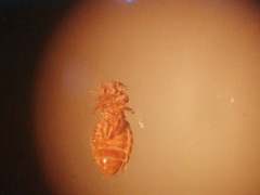 Heterodoxus spiniger