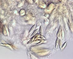 Image of Tapellaria phyllophila