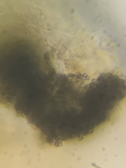 Lichenoconium lecanorae