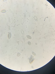 Lecanora circumborealis