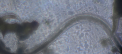 Nematoda