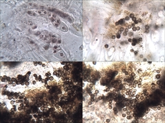 Xanthoriicola physciae