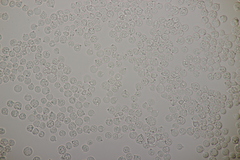 Tremella globispora