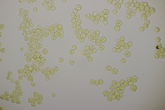 Tremella globispora