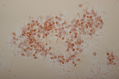 Tremella globispora