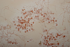 Tremella globispora