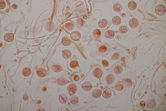 Tremella globispora