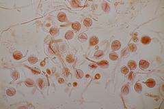 Tremella globispora