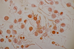 Tremella globispora