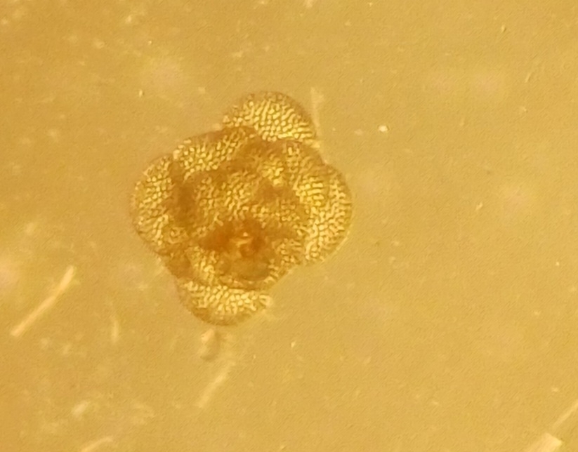 Cymbaloporidae