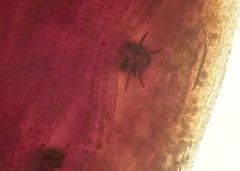 Epibryon interlamellare