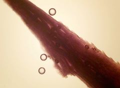 Epibryon interlamellare