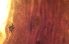 Epibryon interlamellare