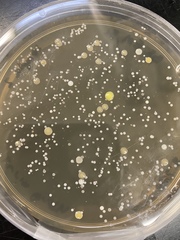 Staphylococcus epidermidis