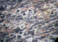 Bactrospora arthonioides