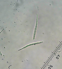 Bactrospora arthonioides