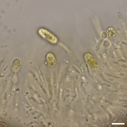Pezicula sp.