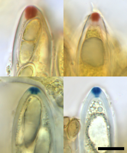 Pezicula sp.