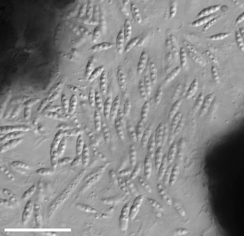 Neovaginatispora fuckelii
