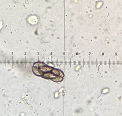 Saccobolus depauperatus