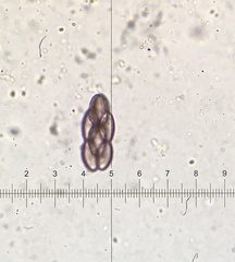 Saccobolus depauperatus