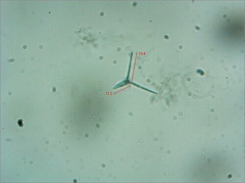 Clavatospora longibrachiata