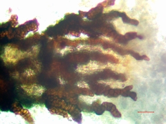 Lichenostigma subradians