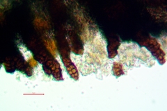 Lichenostigma subradians