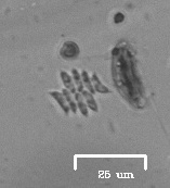 Scenedesmus