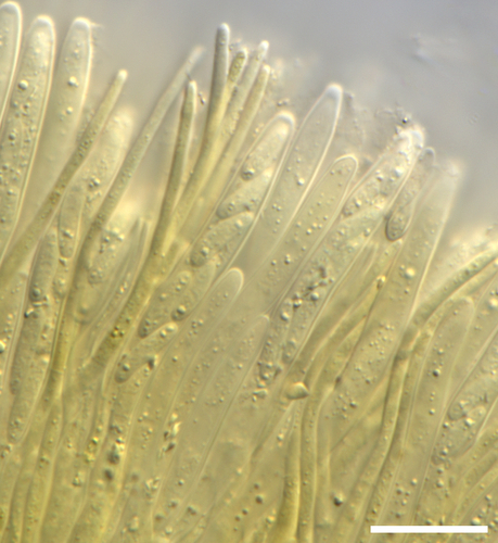 Dasyscyphella sp. 'chrysotexta-VA01'