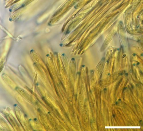 Dasyscyphella sp. 'chrysotexta-VA01'