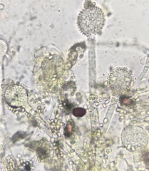 Eurotiomycetes