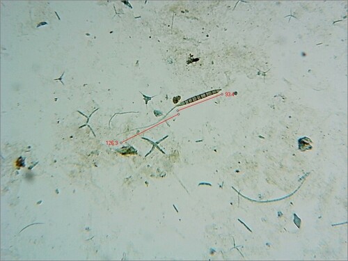 Camposporium
