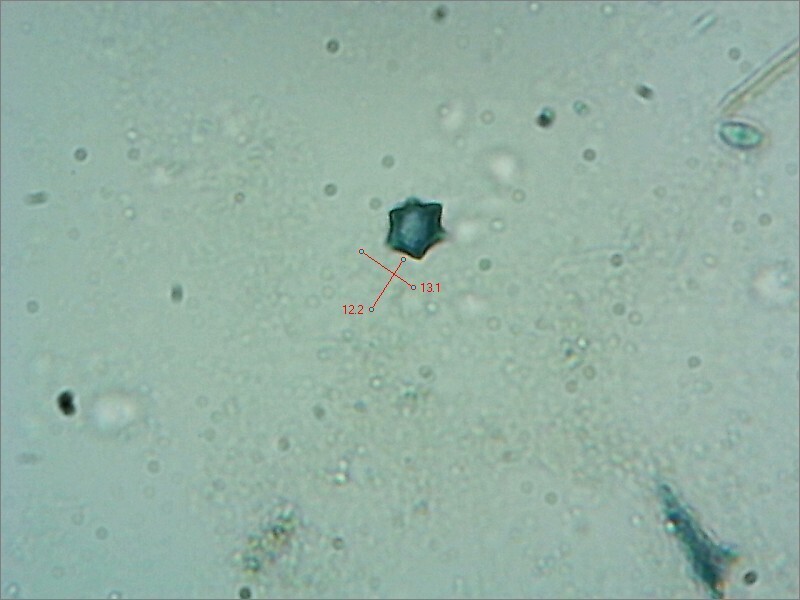 Margaritispora