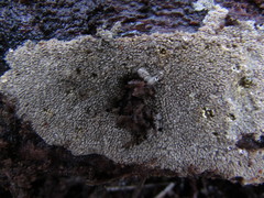 Hyphodontia
