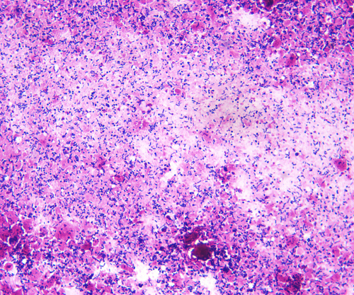 Trueperella pyogenes