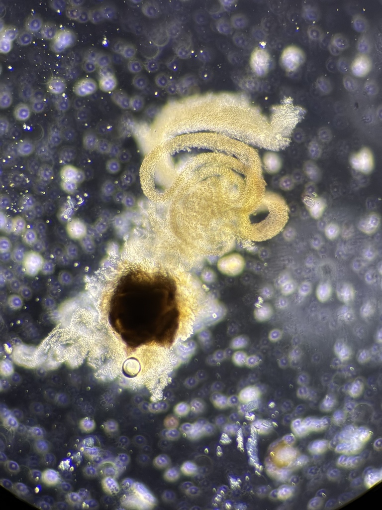 Coniothyrium kochiae