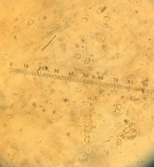 Trechispora hymenocystis