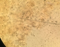 Trechispora hymenocystis