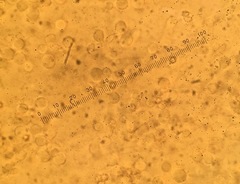 Trechispora hymenocystis