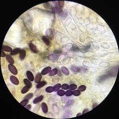 Ascobolus furfuraceus