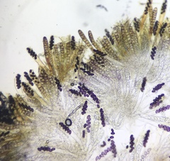 Ascobolus furfuraceus