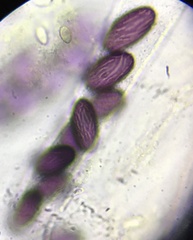 Ascobolus furfuraceus