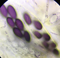 Ascobolus furfuraceus