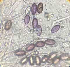 Ascobolus furfuraceus